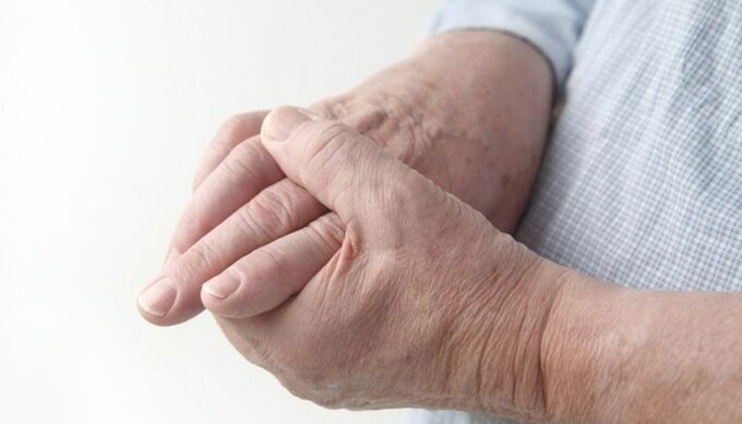 artritis ruku artroza učinkovit tretman hormonalni neuspjeh bolova u zglobovima