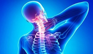 artroza vratnih kralježaka uzrokuje liječenje)