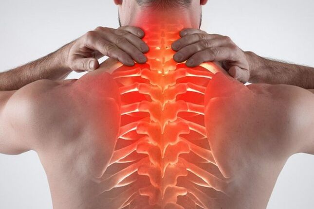 bol u osteohondrozi ramenog zgloba kako liječiti
