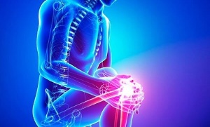 faze artroze zgloba koljena