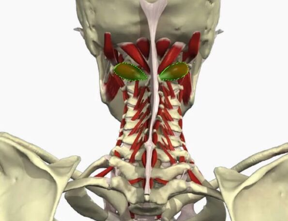 Sindrom vertebralne arterije